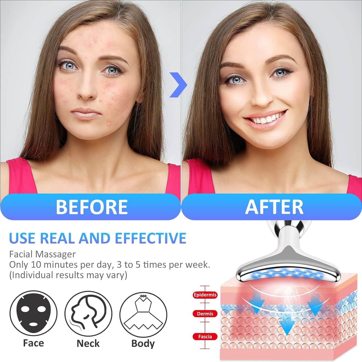 Anti-wrinkle beauty device